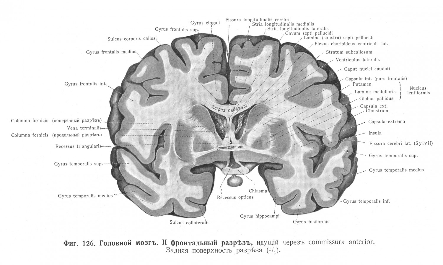 Головной мозг II фронтальный разрез